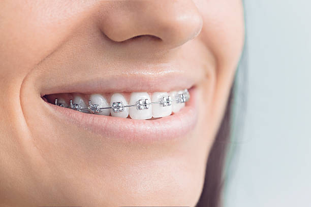 Best Dental Fillings (Composite and Amalgam)  in Summerlin South, NV